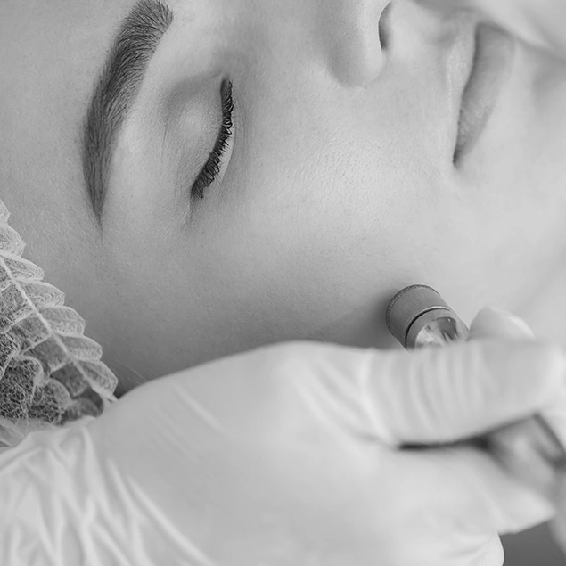 Facials Rosenheim IQ Aesthetics