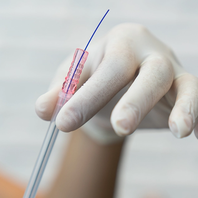 Fadenlifting-Mitte-iq aesthetics